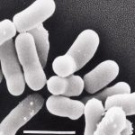 Propionibacterium Freudenreichii